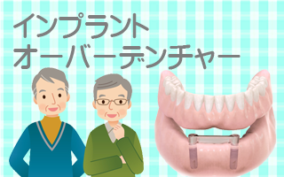インプラントオーバーデンチャー