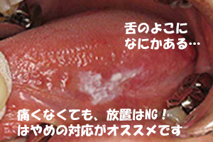 舌写真