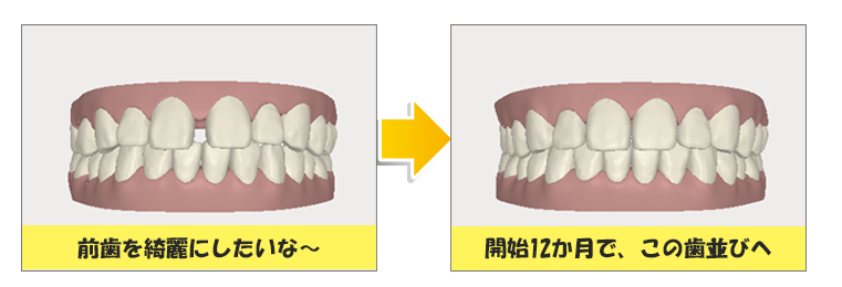 ゴールを見てからスタート